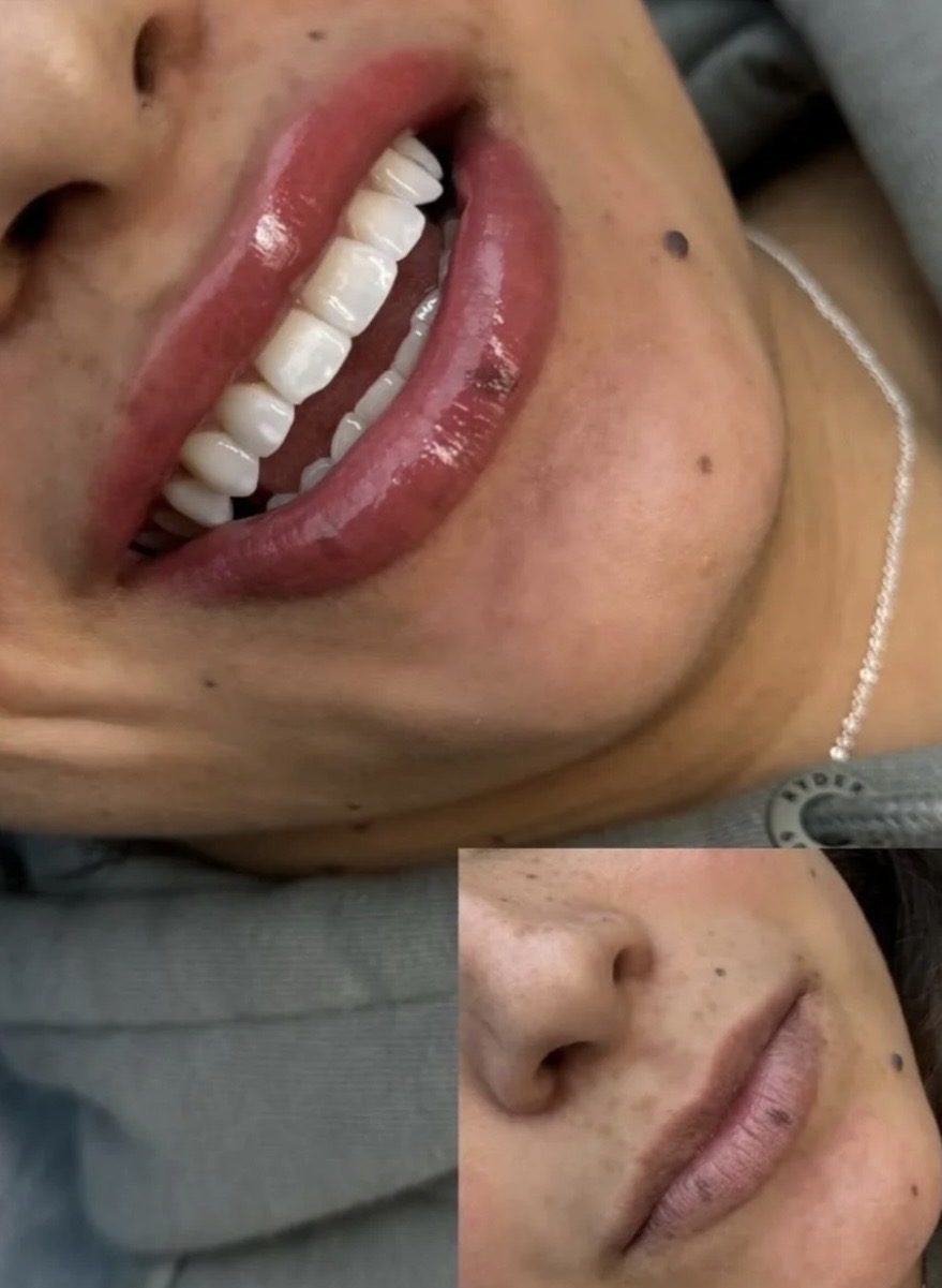 Lips — Marked With Beauty work sample